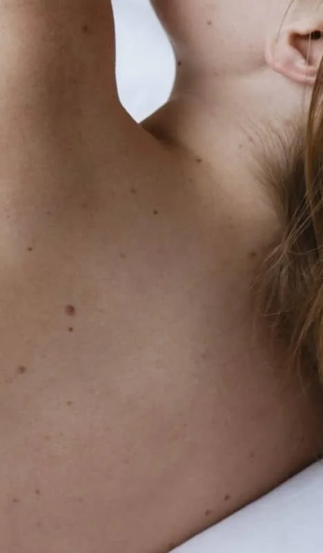 COMO CUIDAR TU BARRERA CUTANEA